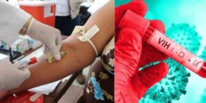 SIDA-VIH-1